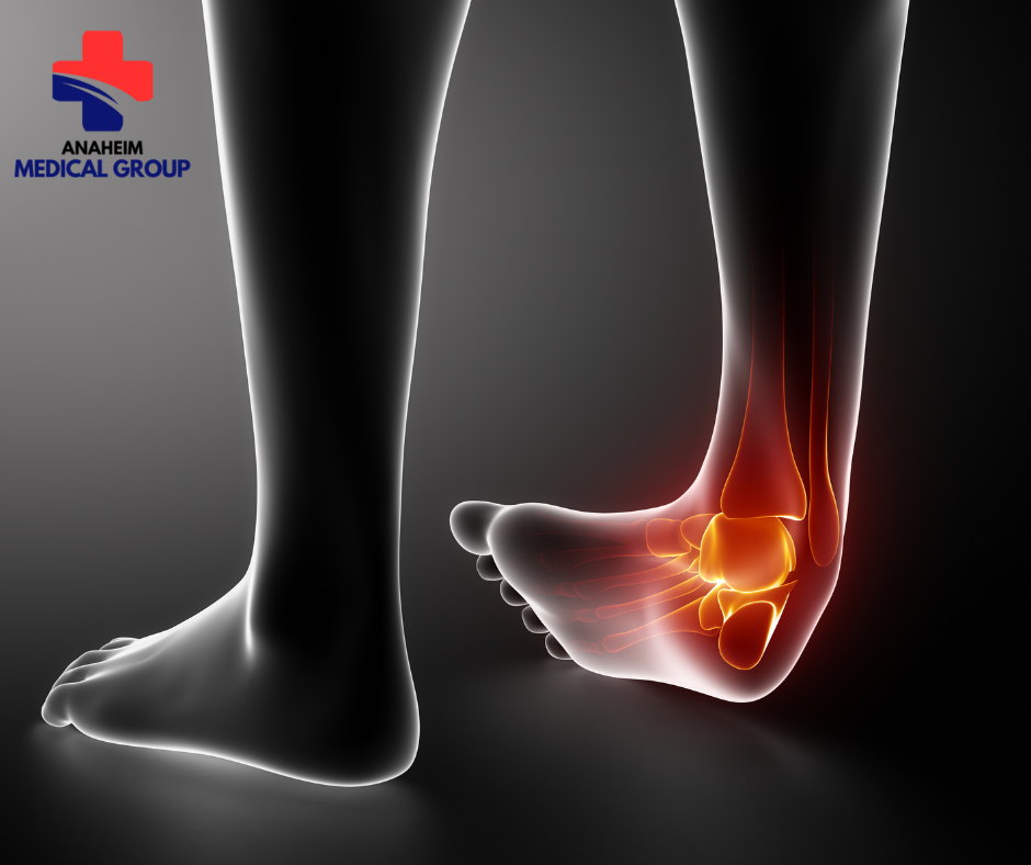 Sprains and Strains Treatment in Anaheim – Anaheim Medical Group — image 2