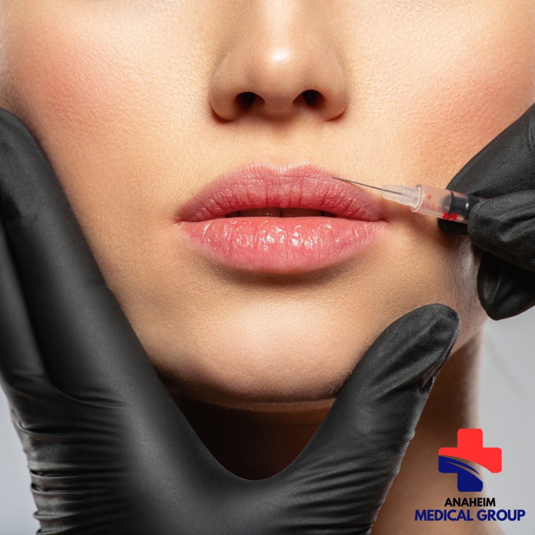 Botox in Anaheim: Why Aesthetics Universe is Your Go-To Clinic — image 4
