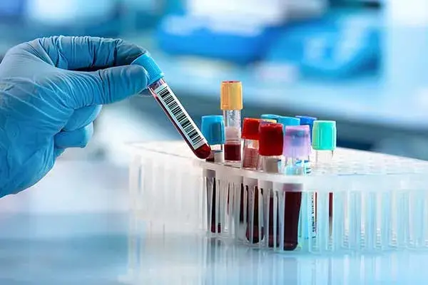 Oncology and hematology care in Anaheim