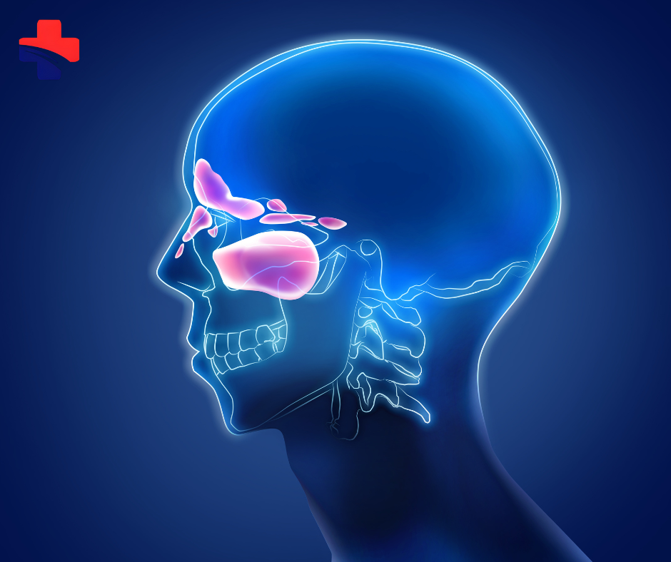 Sinus Infections in Anaheim, CA: Causes, Symptoms, and Expert Care at Anaheim Medical Group — image 5
